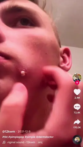 It’s just a pimple. It’s just a pimple.