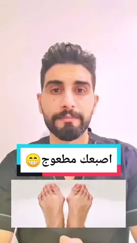 ✳️ مشكله محرجه ومؤلمه لقدمك..... #اكسبلورر #صحة #طبيب_تيك_توك #طبيب #طب #نصيحة_اليوم #اكسبلورر #معلومات_طبية #medical #health #doctor #saudiarabia