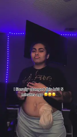 #fyp #bodypositivity #colostomybag #smh #rude