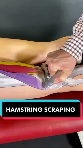 Not the best feeling in the world, but it will have ur muscles feeling amazing 💯 Would u try #musclescraping ? #pain #art #anatomy #tighthammies #fyp