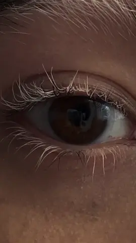 🤍🖤 #vitiligo #myvitiligo #lowexposurefilter #whiteeyebrow #eyes  #lashlift #fyp #whiteeyelashes #poliosis #ShowUsYourDrawers #naturalbeauty #beauty