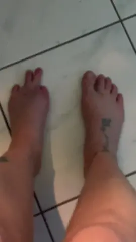 Something About Me You Might Not Know #amputation #sigarettekills #toeamputation #Toeamputees At 36 I Had My Big Toe Amputated Do To A Pedicure