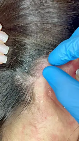 do you have it behind your ear? more videos without limits link in profile