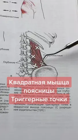 Миофасциальные боли ❌⬛️ квадратной мышцы поясницы #болиткрестец #квадратнаямышца #триггерныеточки #юрийродионов