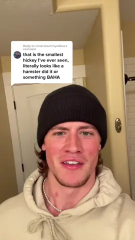 Reply to @reinersmummymilkas not even a hickey 🤷🏻‍♂️