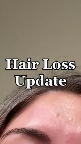 @mabrowsandhair 👈🏻 ask her not me 💁🏼‍♀️ #hairloss #fyp #fypシ #hairhealth #OREOBdayStack #OutlanderChallenge
