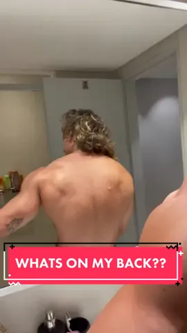 If you got something like this, don’t worry it’s just a cyst. Recovering w/ @tonifyplus CBD Lotion #cyst #whatisthat