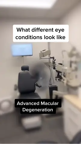 What different eye conditions look like #maculardegeneration #glaucoma #cataracts #diabeticretinopathy
