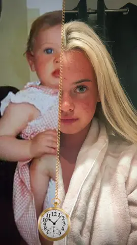 I still have a baby face😩😂 #fyp