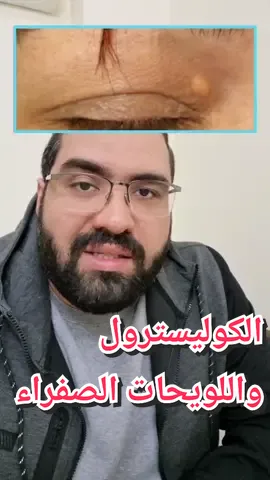 #تعلم #doctorsoftiktok #تريند #علاج #نصيحة_اليوم #البشرة #fyp #مصر #صحة #طب #دكتور_أحمد_أشرف #الفليكساوية_ناصحين #جلدية #اكسبلور #derma #doctorsoftiktok #foryou