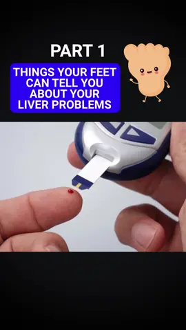 Things Your Feet Can Tell You About Your Liver Problems Part 1 #liver #health #diabetes #liverproblems #feet #reddot #wellness #drericberg #fyp