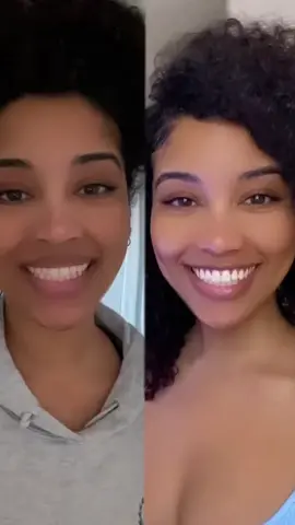 The Perfect Smile Transformation🥰#teethwhitening #fyp #purelywhitedeluxe