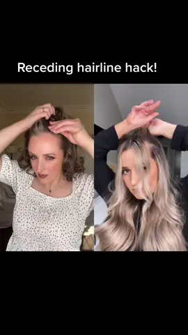 #duet with @alexamcmanaman it really makes a difference! #hairhack #hairlinehack #halfup #halfupdo