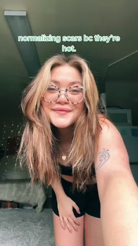 learn 2 love ur scars! #malsawareness #medianarcuateligamentsyndrome #OscarsAtHome #BridgertonScandal #WomenOwnedBusiness #bodypositivity #edrecovry