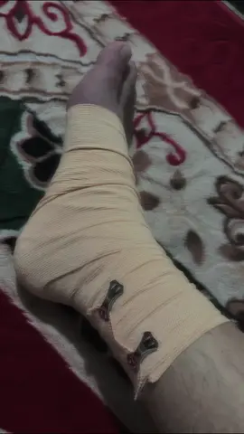 Chấn thương nặng nhất của bạn??? #bóngđá #chấnthuong #lậtcổchân