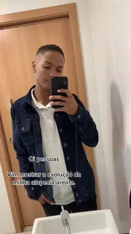 Alopecia areata não é brincadeira!!         #minoxidil #fy #Lucasbbb #alopecia #alopeciaareata #willsmith #cabelo #quedadecabelo