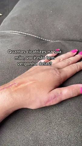 #cicatrizes #gratidãoadeus #mulherforte