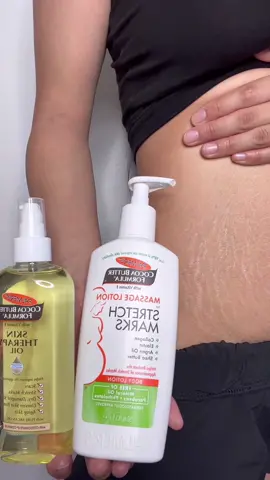 #ad My perfect duo✨Ive learned to love the stripes I’ve carried along my pregnancy. No shame in marks, embrace it as it’s apart of you now and nothing to look down upon💕 @palmersus #palmers #ad