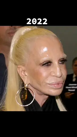 #fpy #viral #blowthisupforme #wtff #fail #plasticsurgery #donatellaversace