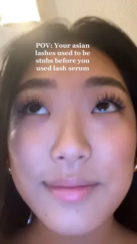 #greenscreenvideo growing my natural lashes was a big confidence boost ❤️ #lashgrowth #lashes #lashroutine #lashserum #lashtherapyaustralia #grandelash #eyelashes