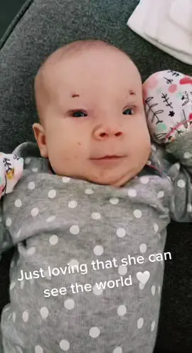 Here is a quick update for everyone that has asked! She is doing great! Happy as can be! #bpes #bpesawareness #myfinALLYmoment #EasyWithAdobeExpress #fyp
