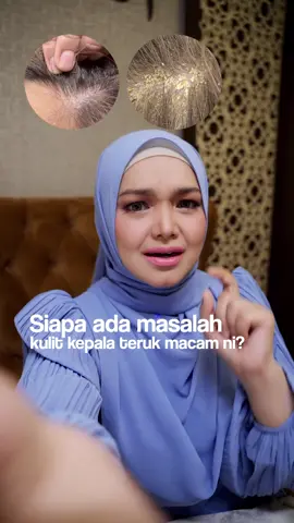 Sharing rahsia sy menjaga mahkota di sebalik hijab.wajib cuba ok! Semoga bermanfaat! #hair #hijab #fyp #fypシ #racuntiktok #tiktokviral #tiktokmalaysia