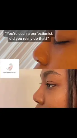I’m a perfectionist so you’re not leaving my sight till I’m happy with my work 🙅🏽‍♀️ #fyp #filler #nonsurgicalrhinoplasty #lipfillerlondon #DidYouKnow #fillerslondon  #viral #lipdissolving #beforeandafter #fatdissolvinginjections