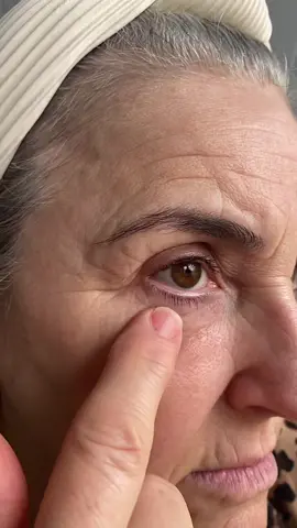 It’s easy to see why Peter Thomas Roth’s FirmX Eye Cream has gone mega-viral… 🤯 (IB: @user3761092853451) #peterthomasroth #skincare #eyecream @Peter Thomas Roth