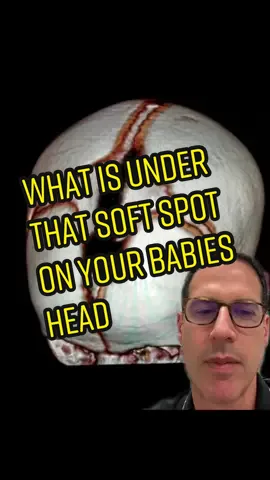Very cool image showing why your #baby has a soft spot on their head‼️ #pregnancy #pregnant #newborn #fypシ #doctorsoftiktok