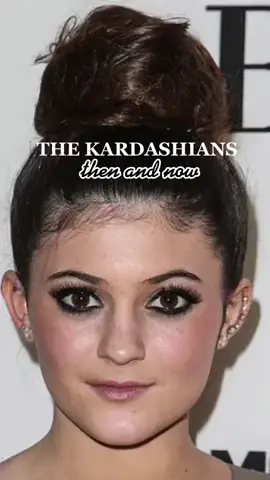 Who else loves before and afters? #foru #kardashians #kardashiansjenner