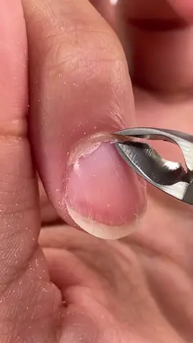 Satisfying Cuticle Removal 💙 #nails #nailtutorial #nailart #acrylicnails #satisfying