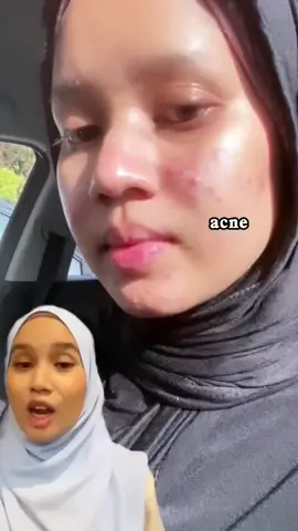 We can have different skin problem tapi one thing yg if kita jaga, skin kita akan improve tremendously. Its our skin barrier!!!#skintificmy #ramadantiktokshopping #skintific