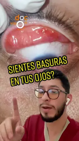 Esta es la razón porque sientes basuras en tus ojos