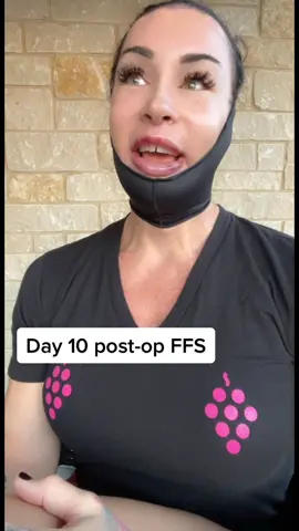 Day 10 post-op facial feminization surgery and I’m feeling sooo much better! #trans #transition #transgender #transwoman #lgbtq #lgbt