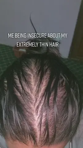 😭 #fyp #fypsounds #onlylovecanhurtlikethis #trending