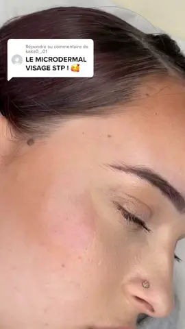 Répondre à @kaka0_.01 et voilà ✨#pourtoi #fyp #viral #lyon #lyonpiercing #piercing #piercings #piercingvideo #microdermal #microdermalpiercing #piercingmicrodermal #paris #parispiercing #studiopiercing #piercinglyon