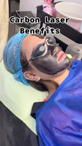 Is A Carbon Laser Peel Worth The Hype?#carbonlaser #carbonfiber #carbonlaserfacial #blackdoll #carbonlaserpeelingtreatment #carbonpeel #facialtreatment