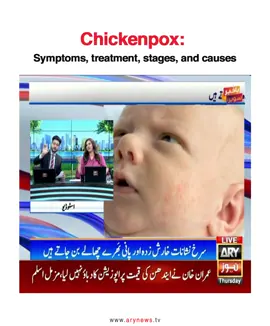 #ARYNews #fyp #fypシ  #foryoupage #ForYou #Health