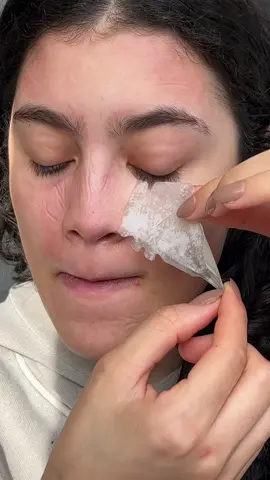 @Hero Cosmetics face patches putting in the work 😍 #pimplepatchresults #hydrocolloidpatch #herocosmetics