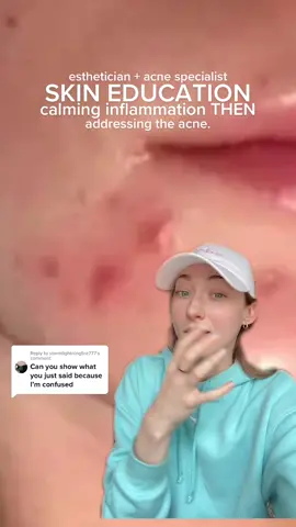 Reply to @stormlightningfire777  hope this helps! #inflammatoryacne #estheticiantips #hormonalacne #inflammation #acneskin