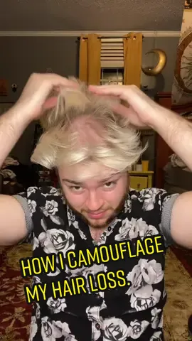Me being very vulnerable, but hopefully this helps others! 💛 #hairloss #hairlosssolutions #hairtutorial #hairlosstiktok #pridemonth #healingtiktok #hairstylist #hairstyletutorial #baldingsolution #bald #dryshampoohack #batiste #dryshampootutorial #menshairstyle #menshairloss #menshairtutorial