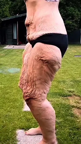 Effective way to lose weight!#CapCut #weightloss #essentialoils #weightlosscheck #foruyou