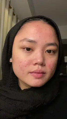 soothing toner 🥺 bisa jadi pilihan hydrating toner yg lagi cari! #skincareacne #hydratingtoner