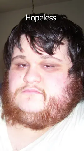 Never give up 💪 #weightlosstransformation #weightloss #beforeandafter #losetogain