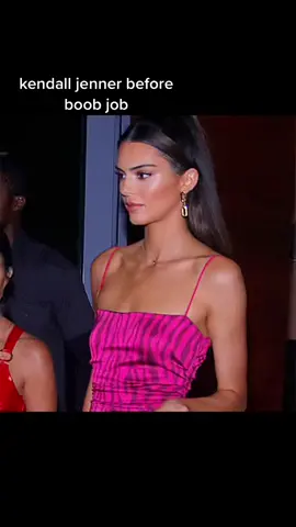 she‘s so pretty #beautiful #surgery #kendalljenner #fyp #iheartwomenxoxo @iheartwomenxoxo