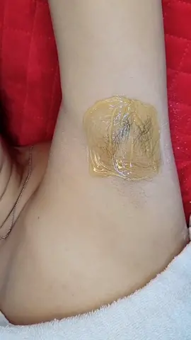 Depilação com Cera Quente- Axilas #depilacaoaxila #axila #cera #ceraquente #depilacaoegipcia