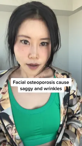 Facial osteoporosis happens even from 40s. Much faster than body osteoporosis. @aloyoga #kokohayashi #kokofaceyoga #faceposture