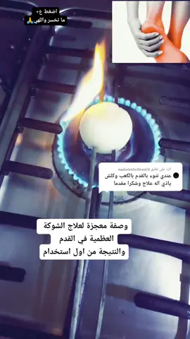 الرد على @nadiafakhri0nadi3  وصفه معجزة لعلاج الشوكة العظمية ✔️ضيفوني انستا❤️الي يحتاج اي شي يعلق ارد ع كل فدوه اكسبلور بالنشر#لاعب_كارليس_جهاد