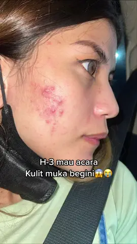 Cocok nih yg skin barrienya lg rusakk sembuhin pake serum 5x ceramide dari @skintific_id ini😍🥰 #skinbarrier #serumviral #ceramide