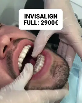 No existen los buenos ALINEADORES, existen los buenos ORTODONCISTAS 😁⚠️ Estamos de promoción INVISILAING FULL 2900€ hasta el 30 de junioSi tienes alguna duda escríbela en los comentarios😉#ortodoncia #ortodonciainvisible #invisalign #invisalignmadrid #invisaligndoctor #invisaligndoctor #ortodonciamadrid #nuevasonrisa #ortodoncia #alineadoresinvisalign #alineadorestransparentes #escanerintraoral #dentistainvisalign #madrid #madridespaña🇪🇸